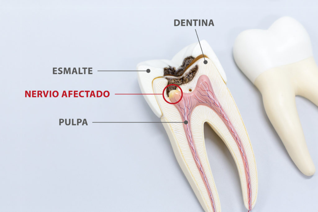 Endodoncia en clínica dental en ciudad real endodoncia en ciudad real Endodoncia en Ciudad Real tratamientos endodoncia dentista en ciudad real 1024x683